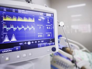 Σε κρίσιμη κατάσταση στη ΜΕΘ ο 32χρονος μετά το σφοδρό τροχαίο με μηχάνημα έργων