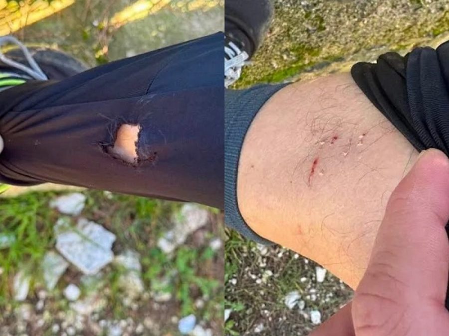 Πολίτες δέχτηκαν επίθεση από αδέσποτα σκυλιά στο περιαστικό Δάσος Φρόντζου